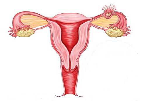 Есть ли менструация после удаления матки