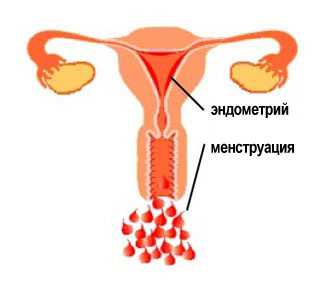 Одна из основных причин бесплодия и нарушения менструального цикла